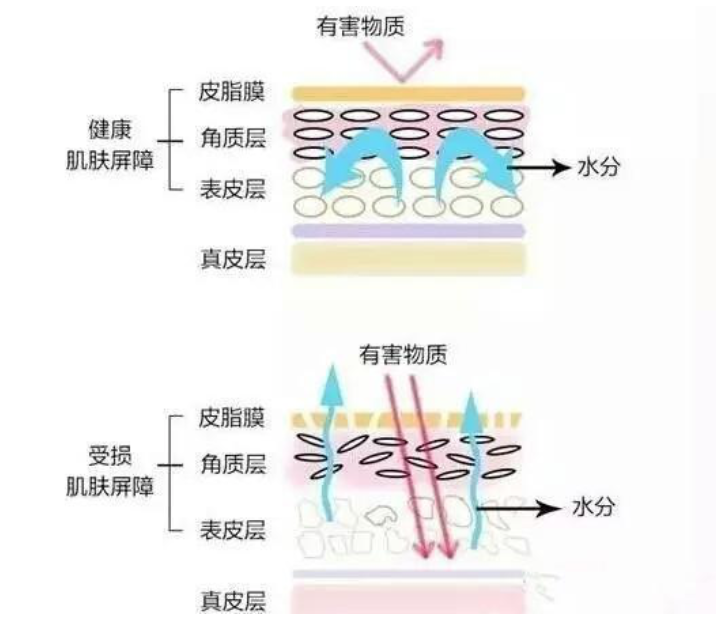 干、癢、紅、腫？別慌涂護(hù)膚品，先看看皮膚屏
